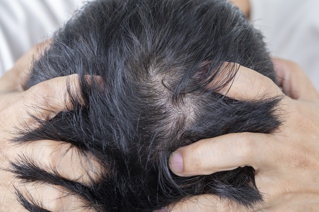 防脱洗发水_中国洗发水上市公司_素人物屿去屑止痒洗发水